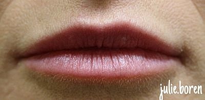 Cheek Fillerzz Before & After