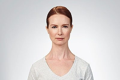 Cheek Fillerzz Before & After